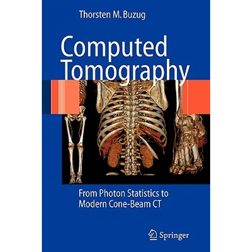 Computed Tomography: From Photon Statistics to Modern Cone-Beam CT